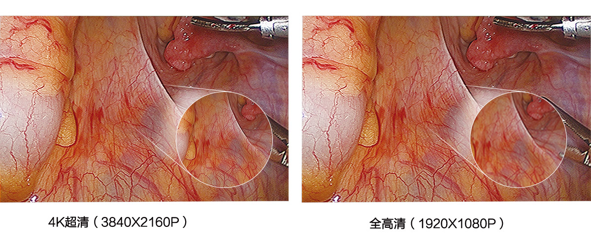 益柯達4K超高清內窺鏡攝像系統(tǒng)