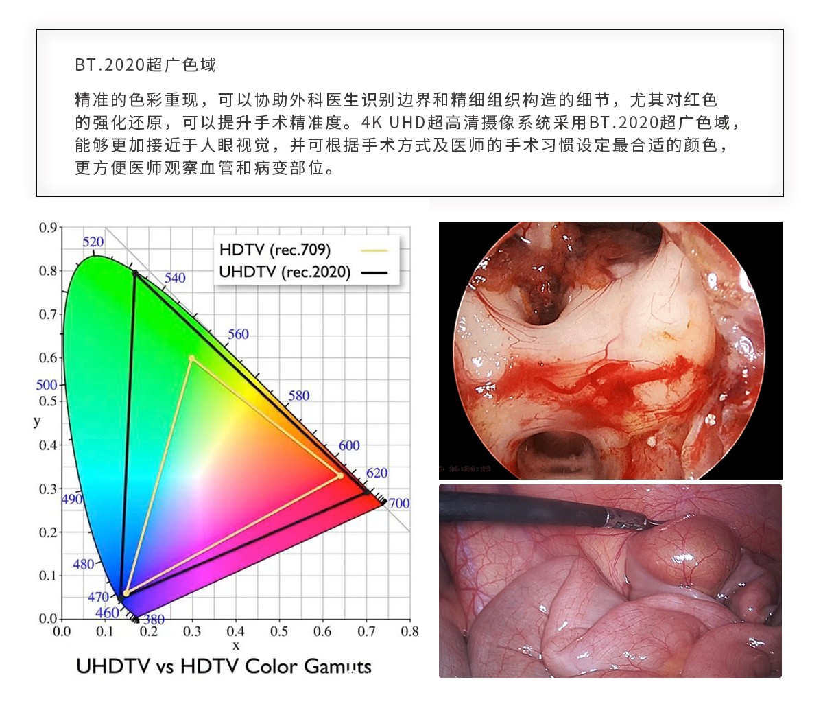 【4K醫(yī)用內(nèi)窺鏡攝像系統(tǒng)】您的第一臺“4K”找到了嗎？