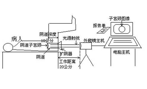 如何使用數(shù)碼電子陰道鏡?